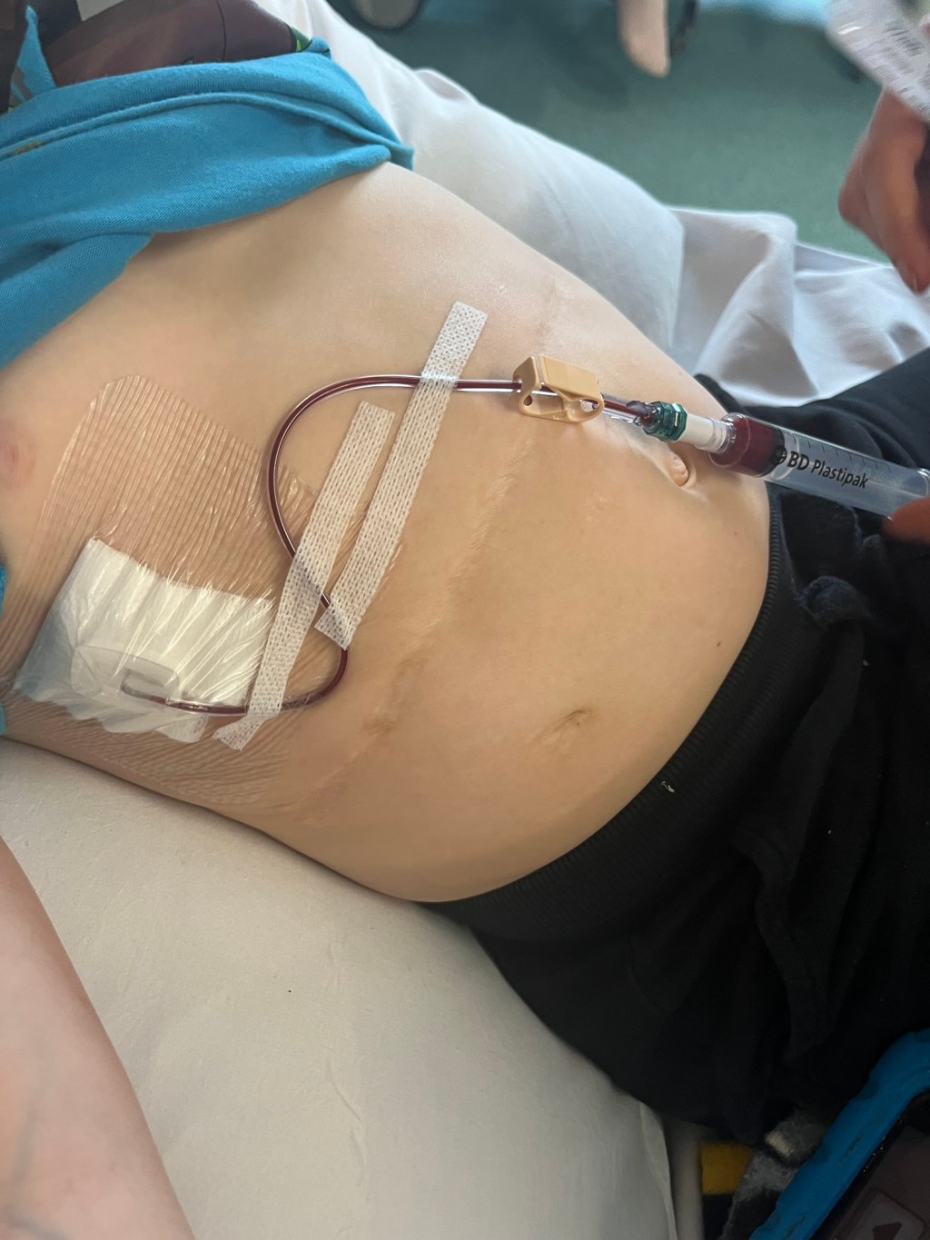 Bumps In the Road-Blood&nbsp;Taking